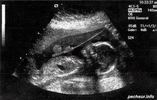 fishing 2 - 548959434472726600534298808678n.jpg